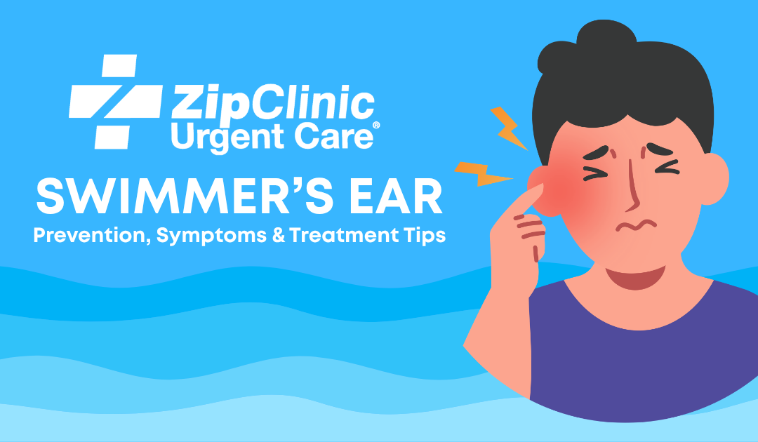 Swimmer’s Ear: Prevention, Symptoms & Treatment Tips